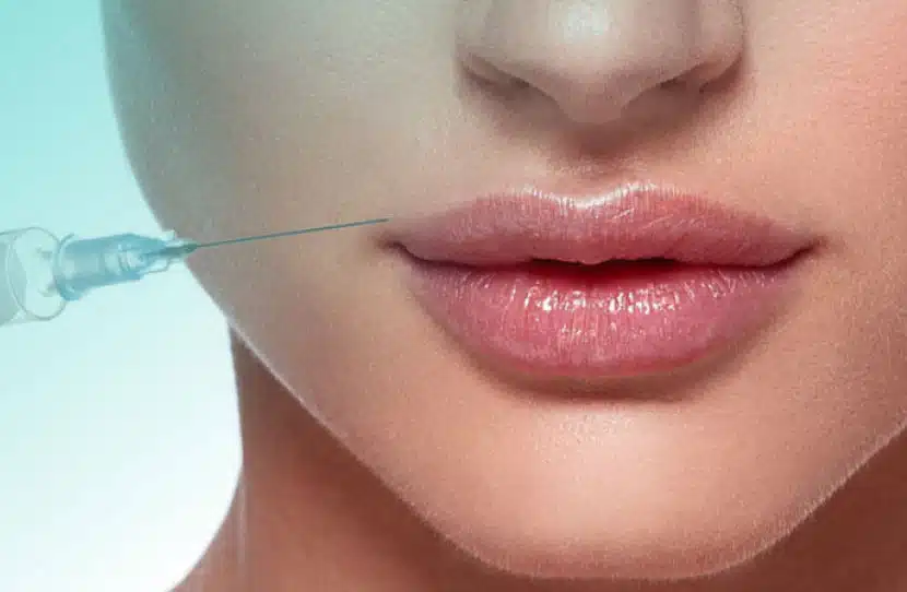 San Antonio Dermal Filler Experts - Latest Filler Treatments