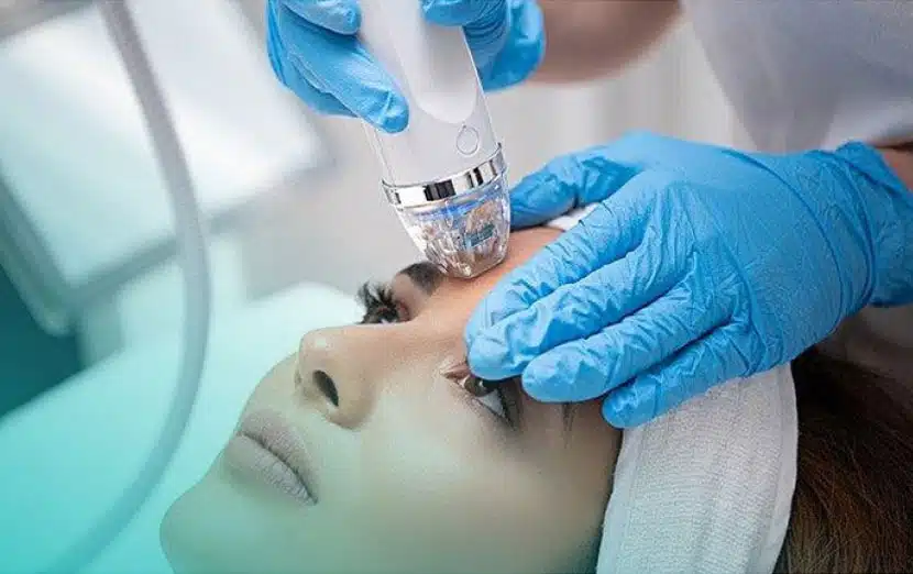 https://jovem-medspa.com/wp-content/uploads/2023/07/520665029-secret_rf_microneedling_2c552c36-819a-42c5-85f5-d410f55c3782.jpg